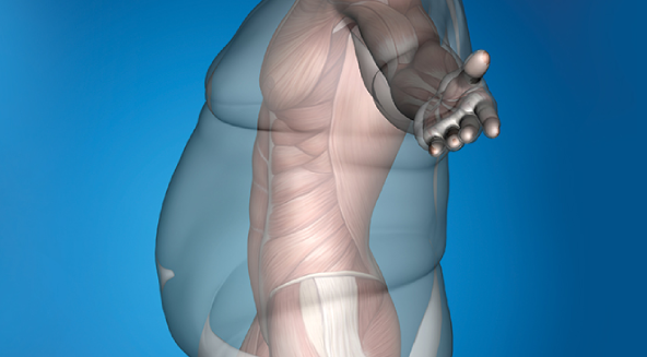 Rebirth with Obesity Surgery