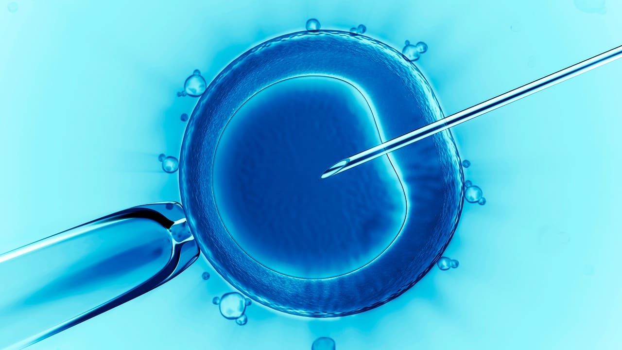In Vitro Fertilization (IVF)