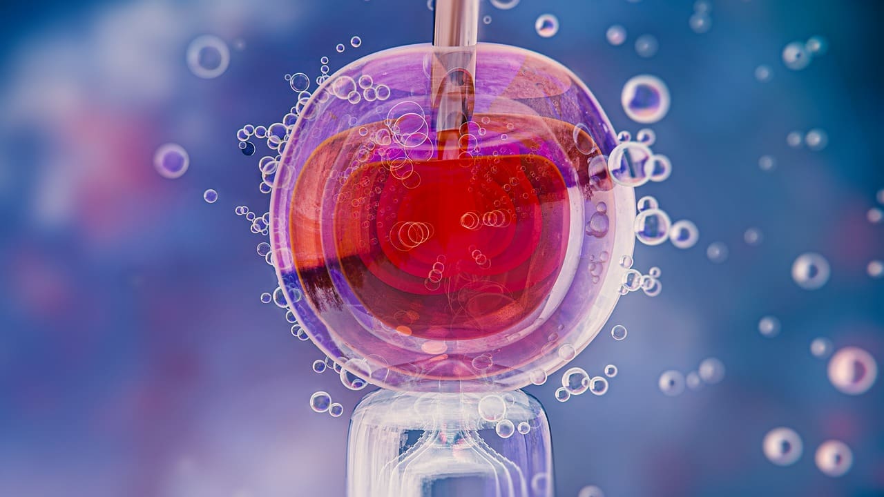 In Vitro Fertilization (IVF)