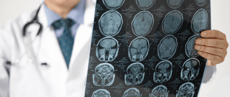 Brain Tumor