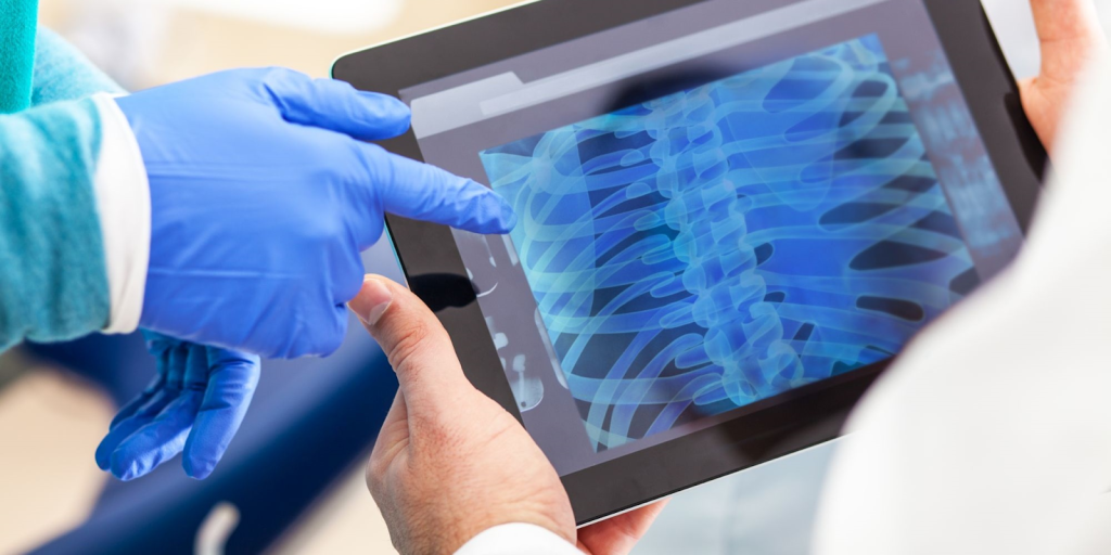 Arthritis Confirming Scan: Powerful Detection for Early Diagnosis