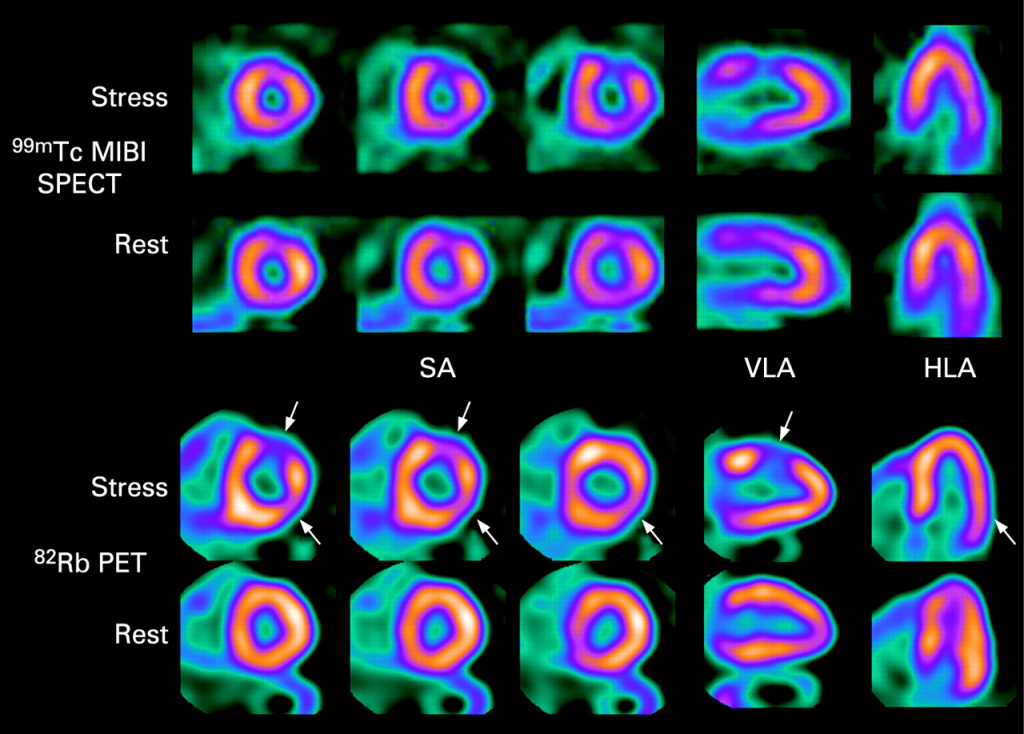 Nuclear Medicine Colors: Powerful Visuals for Disease Diagnosis
