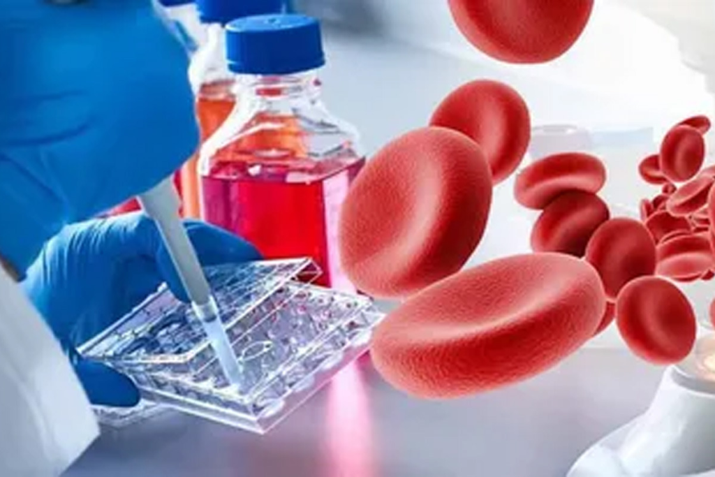 Haematology Hematology: Chemo's Impact on Blood Disorders