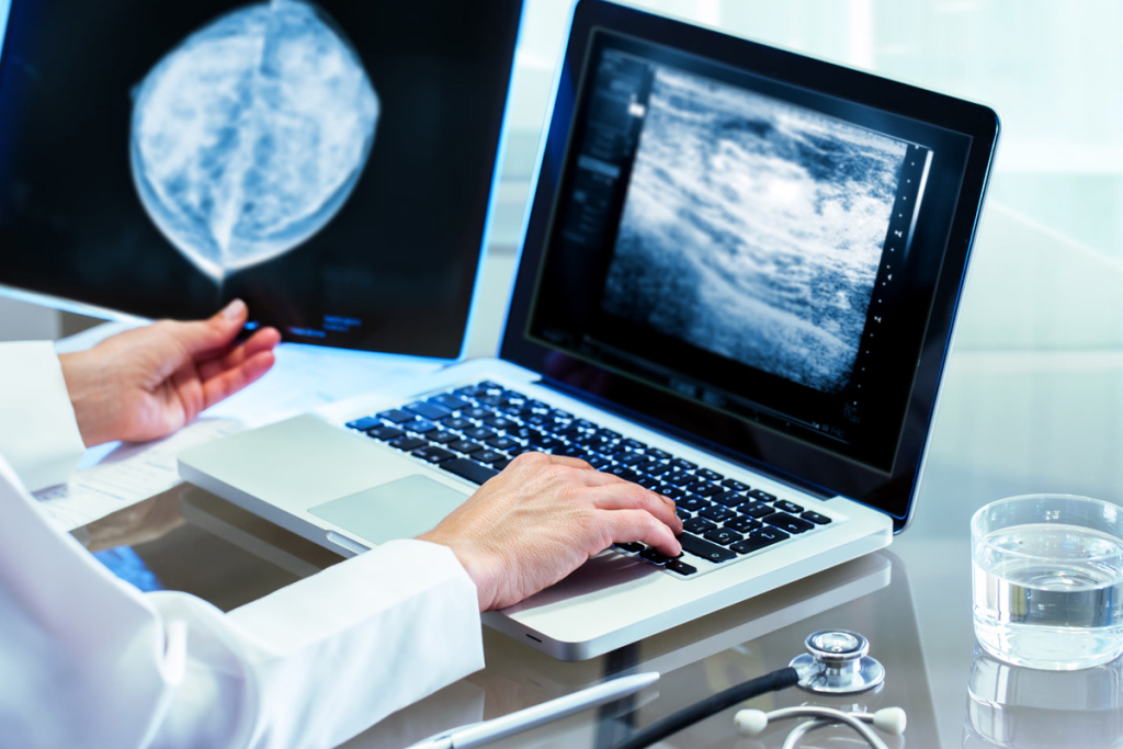 PET Scan Lungs: Detecting Lung Disease, Cancer, and Infections Early