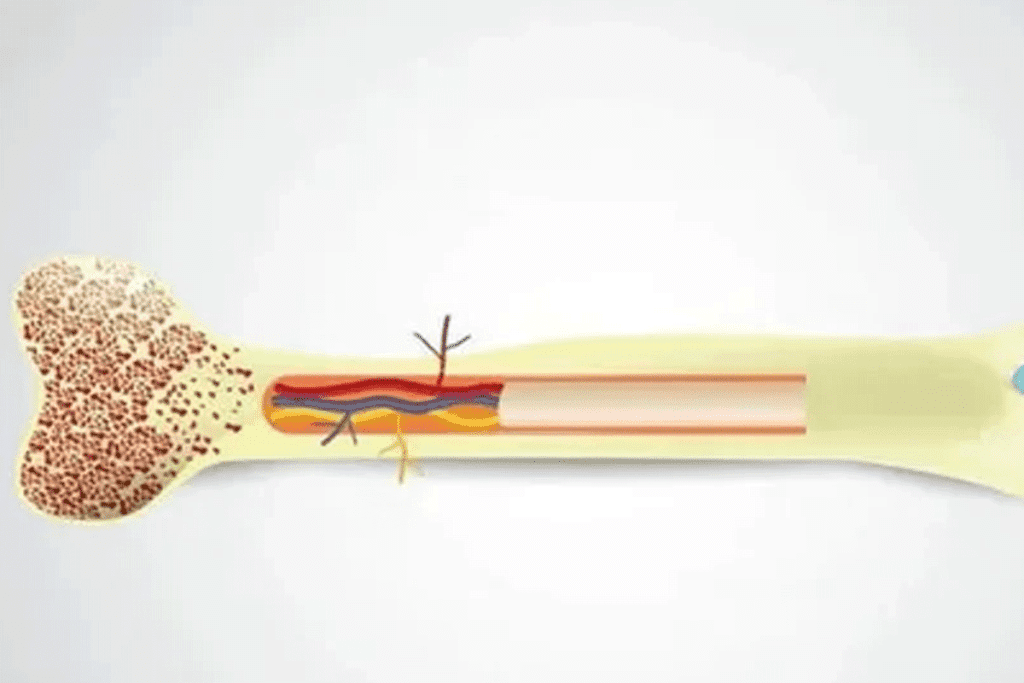 How to Donate Bone Marrow: What You Need to Know