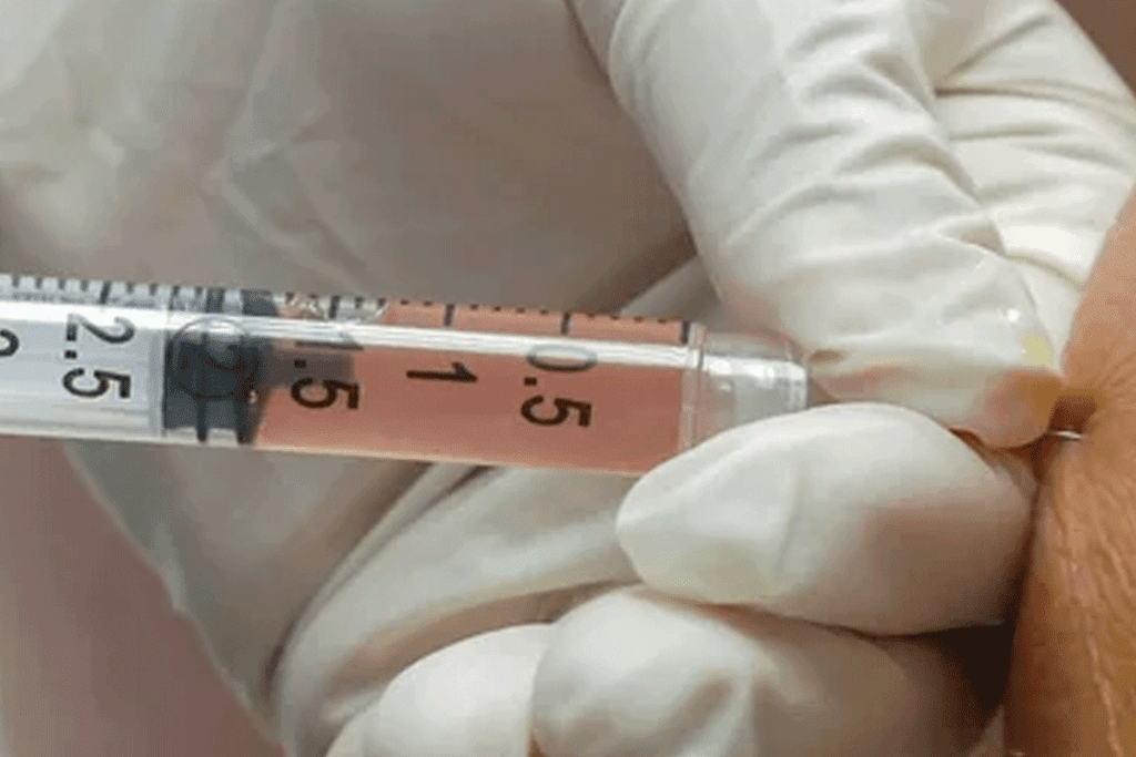 Duration of Stem Cell Injections: How Long Do They Last?