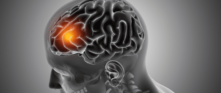 Brain Tumor