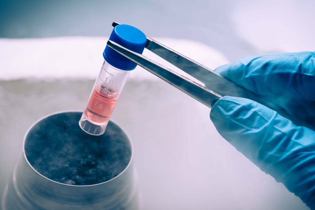 Stem Cell Injection: Advanced Healing Treatment