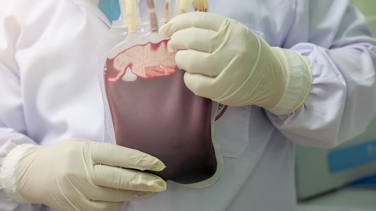 Organ Transplantation