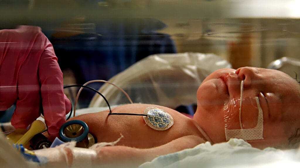 Pediatric Intensive Care