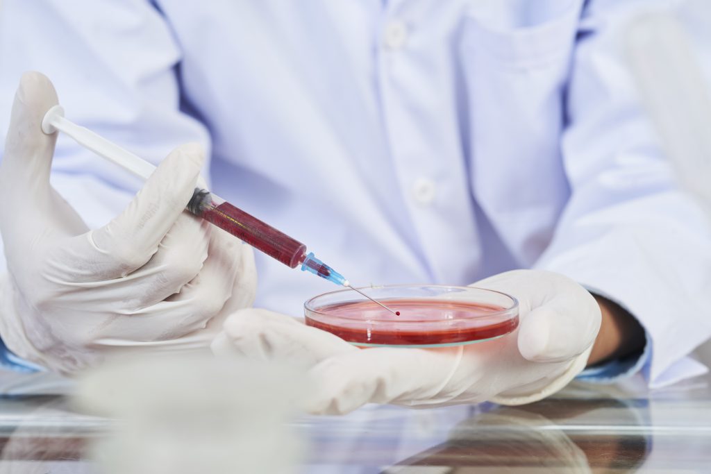 allogeneic stem cell transplant
