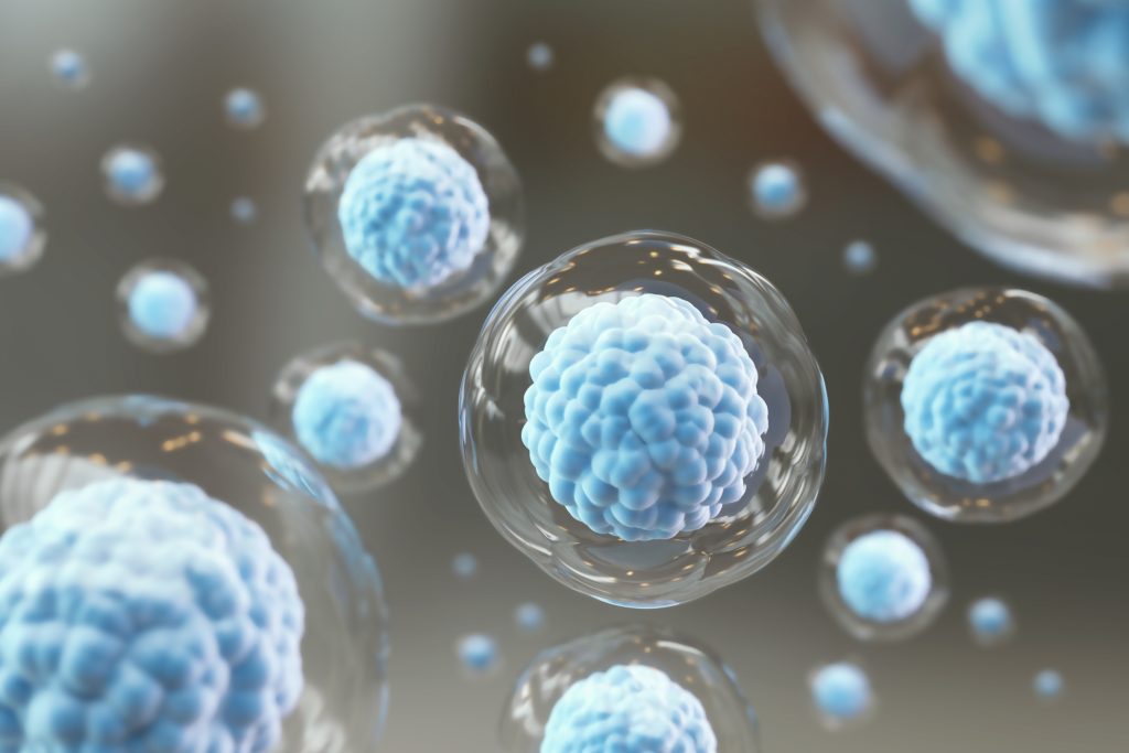 who is not a good candidate for stem cell transplant