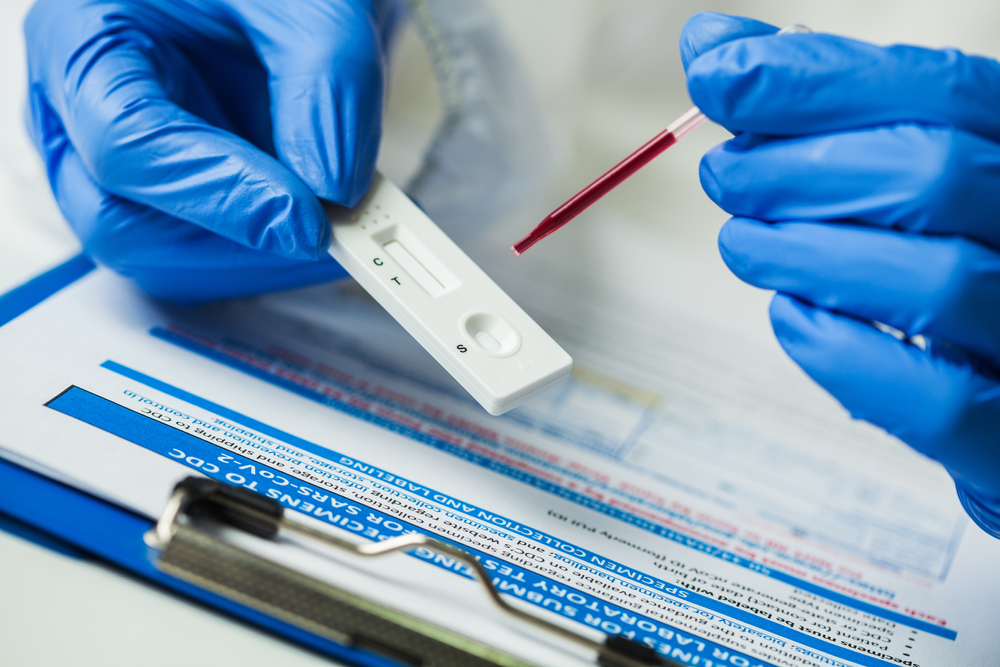 stem cell