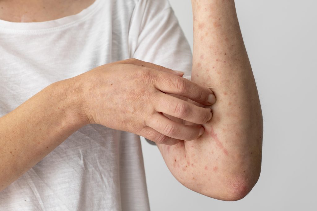Can stomach cancer cause itchy skin
