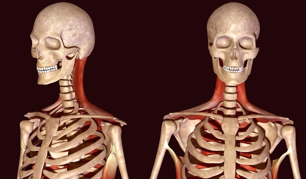A cross-section of the skeletal structure A cross-section of the skeletal structure