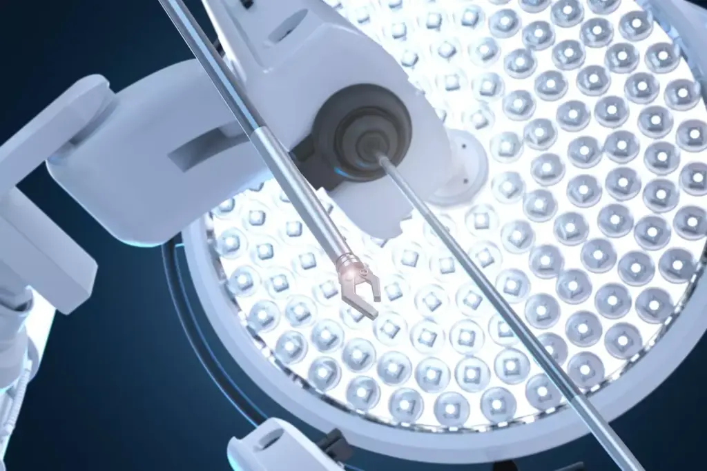 A detailed, chronological illustration of the evolution of minimally invasive surgical techniques. In the foreground, a classic laparoscopic procedure with a surgeon manipulating slender instruments through small incisions. In the middle ground, a modern robotic surgery system with the surgeon seated at a console, controlling the robotic arms. In the background, a montage of historical advancements - from the early endoscopic tools of the 19th century to the high-tech, computer-assisted procedures of today. Soft, muted colors and dramatic, theatrical lighting convey the serious, clinical atmosphere of the surgical theater. The composition emphasizes the technological progress that has transformed the field of minimally invasive surgery over time. A detailed, chronological illustration of the evolution of minimally invasive surgical techniques. In the foreground, a classic laparoscopic procedure with a surgeon manipulating slender instruments through small incisions. In the middle ground, a modern robotic surgery system with the surgeon seated at a console, controlling the robotic arms. In the background, a montage of historical advancements - from the early endoscopic tools of the 19th century to the high-tech, computer-assisted procedures of today. Soft, muted colors and dramatic, theatrical lighting convey the serious, clinical atmosphere of the surgical theater. The composition emphasizes the technological progress that has transformed the field of minimally invasive surgery over time.