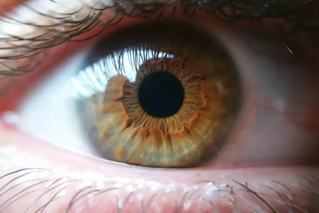 A detailed close-up view of a human eye, with the iris and pupil prominently visible. The eye appears strained and irritated, with a hazy, unfocused gaze. In the background, a faint outline of the brain is visible, with a glowing, ominous-looking mass disrupting its normal structure. The lighting is dramatic, with a combination of warm and cool tones, creating a sense of unease and tension. The lens is slightly wide-angled, drawing the viewer's attention to the unsettling connection between the eye and the underlying brain tumor. The overall mood is one of disquiet and the realization of the profound impact that brain cancer can have on a person's visual perception and daily life. A detailed close-up view of a human eye, with the iris and pupil prominently visible. The eye appears strained and irritated, with a hazy, unfocused gaze. In the background, a faint outline of the brain is visible, with a glowing, ominous-looking mass disrupting its normal structure. The lighting is dramatic, with a combination of warm and cool tones, creating a sense of unease and tension. The lens is slightly wide-angled, drawing the viewer's attention to the unsettling connection between the eye and the underlying brain tumor. The overall mood is one of disquiet and the realization of the profound impact that brain cancer can have on a person's visual perception and daily life.