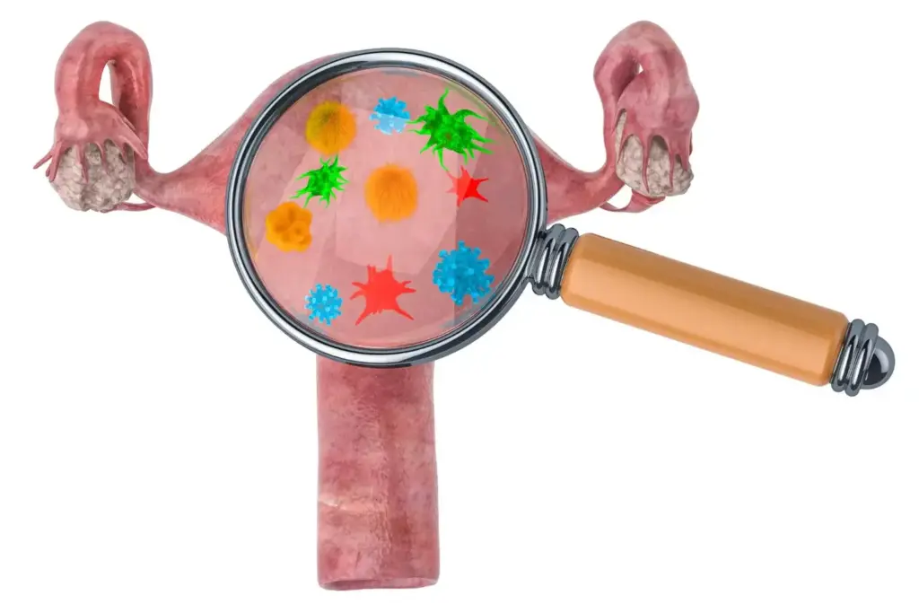 A detailed, scientifically accurate illustration of ovarian cancer treatment approaches. In the foreground, a cross-section of the female reproductive system, highlighting the ovaries and fallopian tubes. In the middle ground, various treatment modalities are depicted, such as chemotherapy infusions, targeted therapies, and radiation therapy. The background showcases a molecular diagram representing the underlying genetic and cellular mechanisms of ovarian cancer. The lighting is soft and directional, casting subtle shadows to convey depth and volume. The overall tone is informative and educational, with a clinical yet approachable aesthetic.