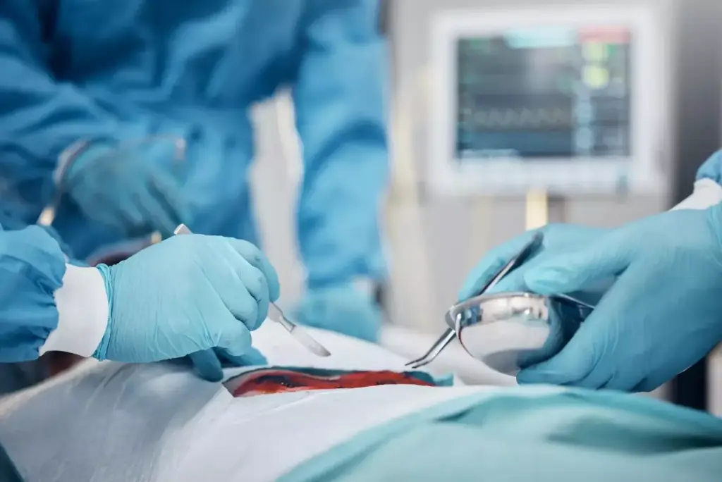 A detailed surgical scene showcasing minimally invasive techniques. In the foreground, the surgeon's hands skillfully manipulate slender instruments through a small incision, with a high-resolution view of the surgical site. The middle ground reveals the patient's body under the surgeon's careful attention, the incision site neatly closed. In the background, the sterile surgical environment is illuminated by bright, diffused lighting, creating a clinical yet calming atmosphere. The image conveys the precision, control, and minimally invasive nature of modern surgical approaches. A detailed surgical scene showcasing minimally invasive techniques. In the foreground, the surgeon's hands skillfully manipulate slender instruments through a small incision, with a high-resolution view of the surgical site. The middle ground reveals the patient's body under the surgeon's careful attention, the incision site neatly closed. In the background, the sterile surgical environment is illuminated by bright, diffused lighting, creating a clinical yet calming atmosphere. The image conveys the precision, control, and minimally invasive nature of modern surgical approaches.