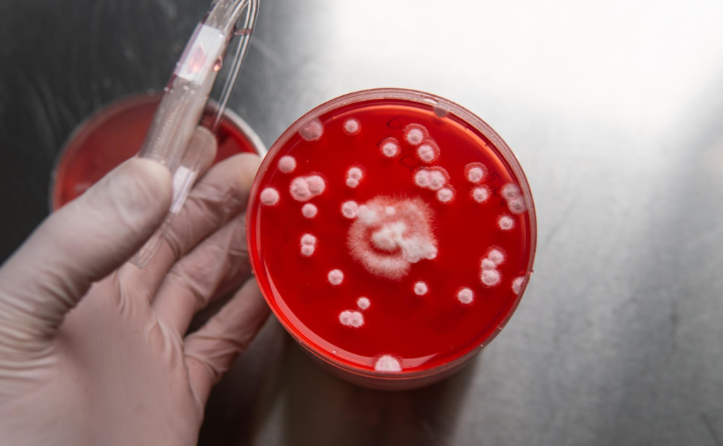 Acute Myeloid Leukemia Survival Rate Bone Marrow Transplant Statistics Acute Myeloid Leukemia Survival Rate Bone Marrow Transplant Statistics