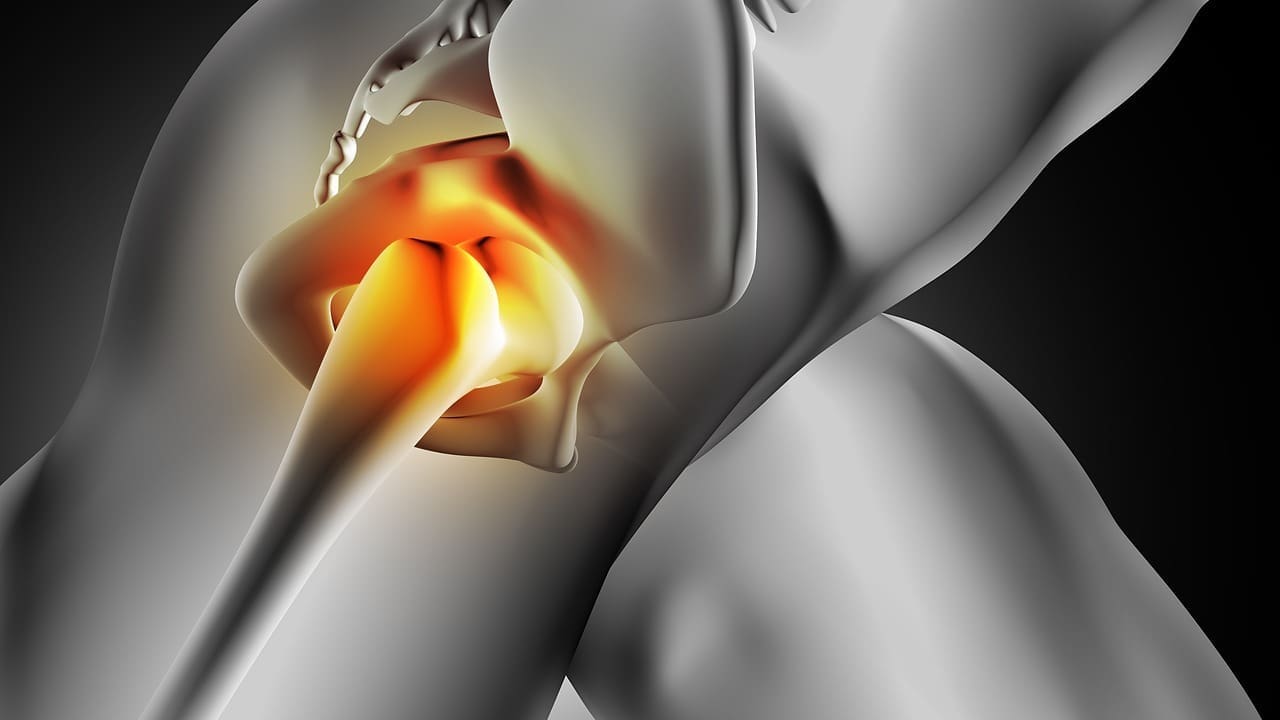 Why Does the Back of My Thigh Hurt? Causes, Symptoms, and When to Seek Help