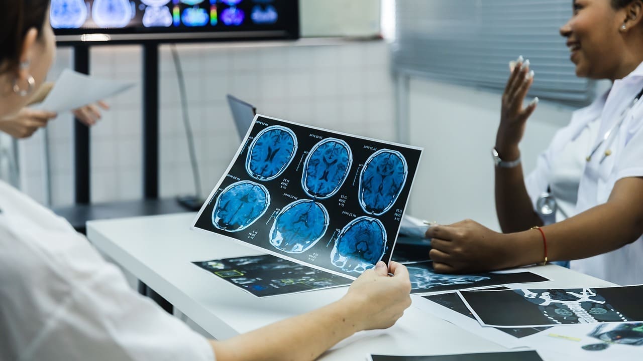 Brain Stem Glioma: 10 Key Facts About Diagnosis, Treatment, and Prognosis