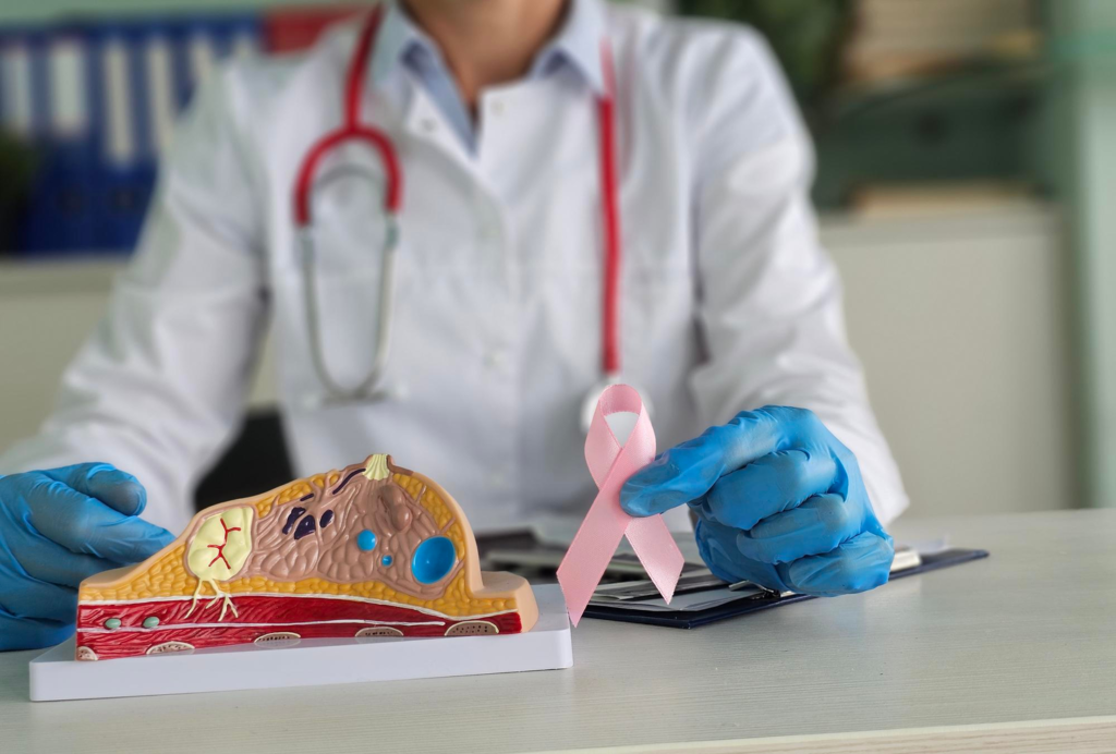 Breast Cancer: Epidemiology and Impact Breast Cancer: Epidemiology and Impact