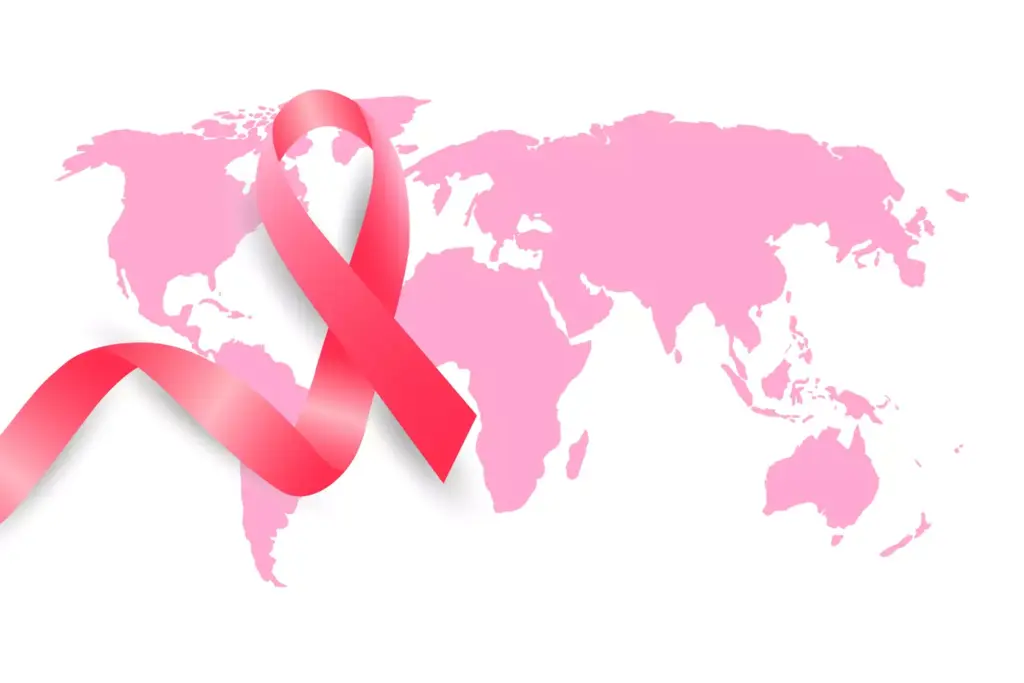 Breast Cancer Statistics Worldwide Breast Cancer Statistics Worldwide