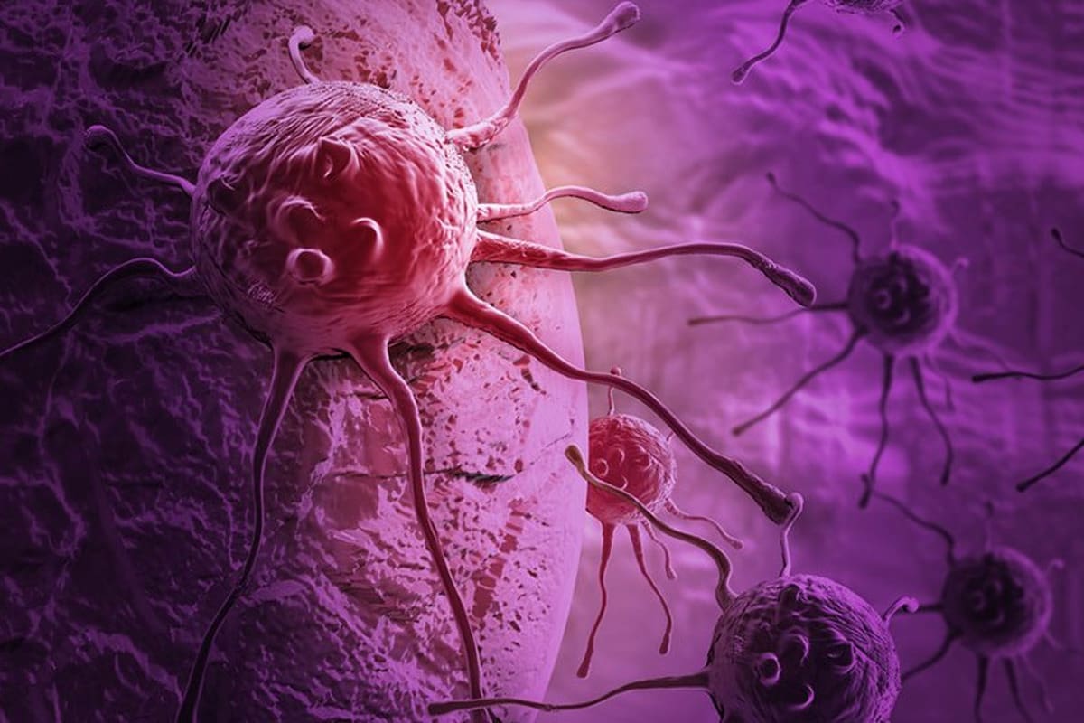 Most Deadly Cancer: Facts on Aggressive Types