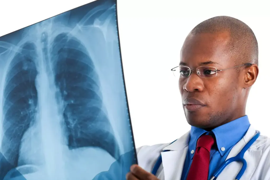 Detailed medical illustration of a NSCLC diagnosis, depicting a computed tomography (CT) scan of the lungs in a clinical setting. The foreground shows a high-resolution 3D rendering of a non-small cell lung cancer tumor, with its characteristic irregular shape and heterogeneous texture. In the middle ground, a radiologist examines the CT scan, highlighting the affected region. The background features a well-lit, sterile hospital environment, with medical equipment and diagnostic displays. The overall mood is one of clinical professionalism and scientific precision, conveying the gravity and importance of diagnosing this type of lung cancer.