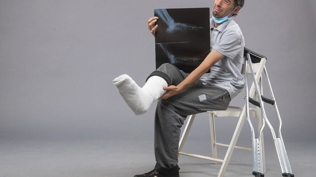 Incomplete Paraplegia Incomplete Paraplegia