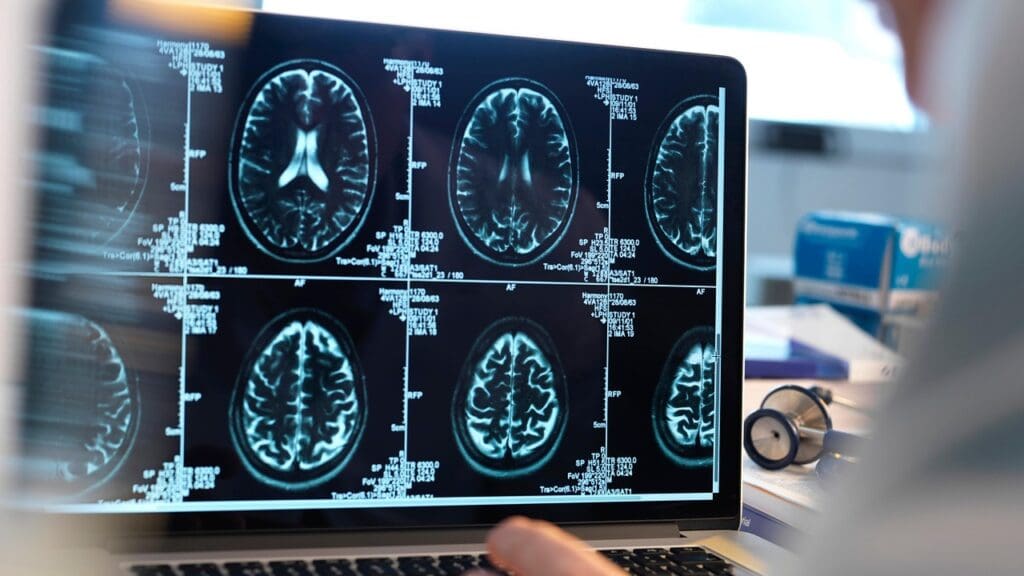 MRI brain imaging technology