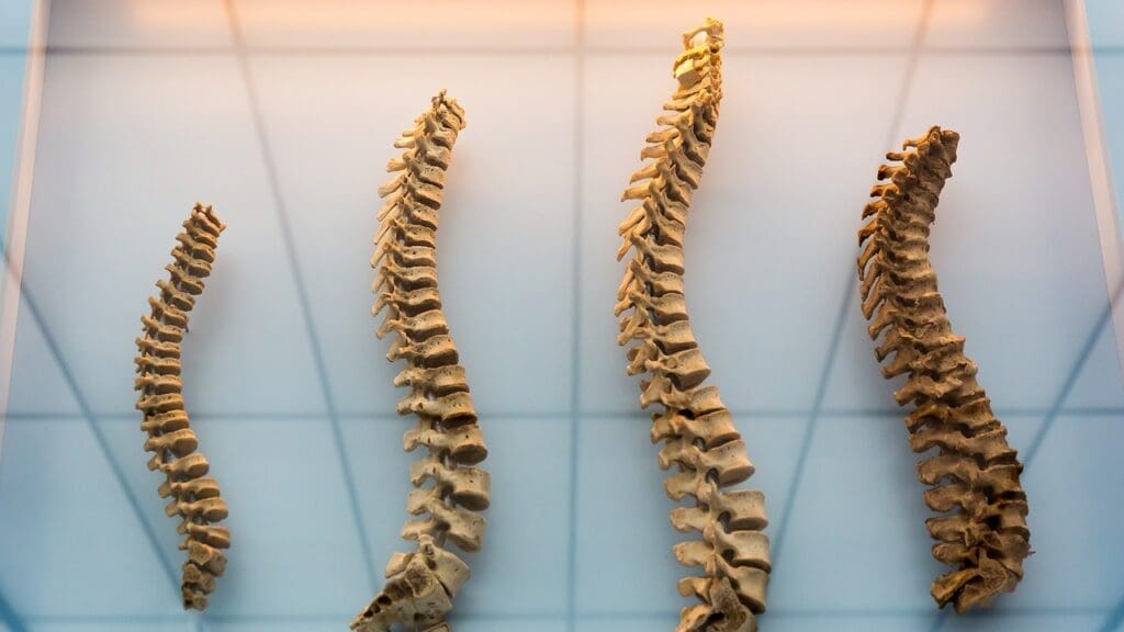 Spinal Cord Injury Levels Spinal Cord Injury Levels