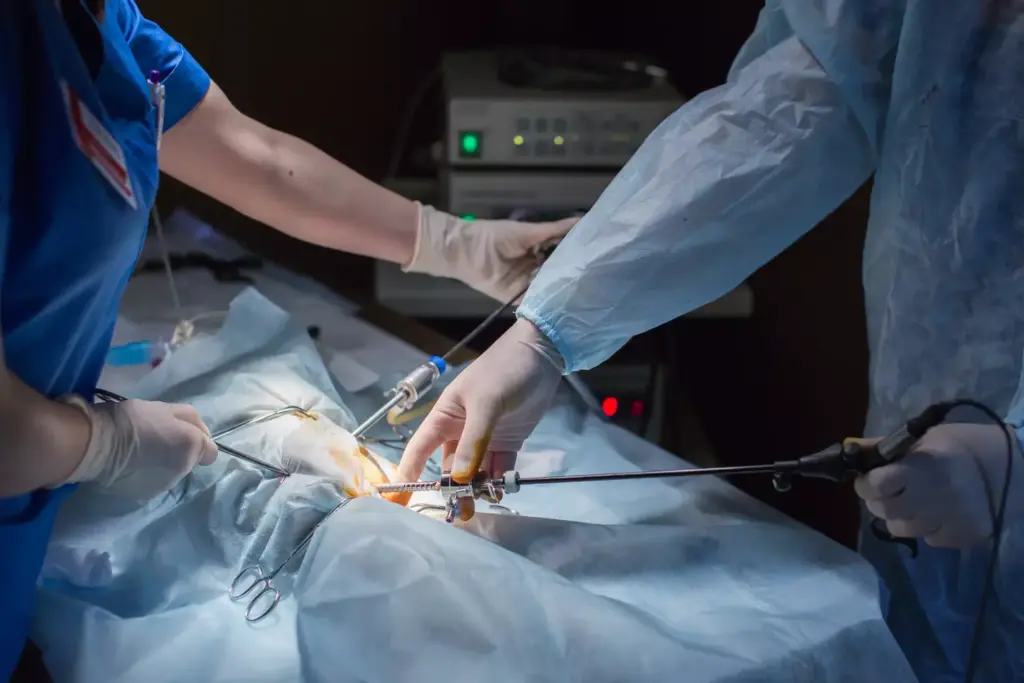 Understanding Ascending Aortic Aneurysms Understanding Ascending Aortic Aneurysms