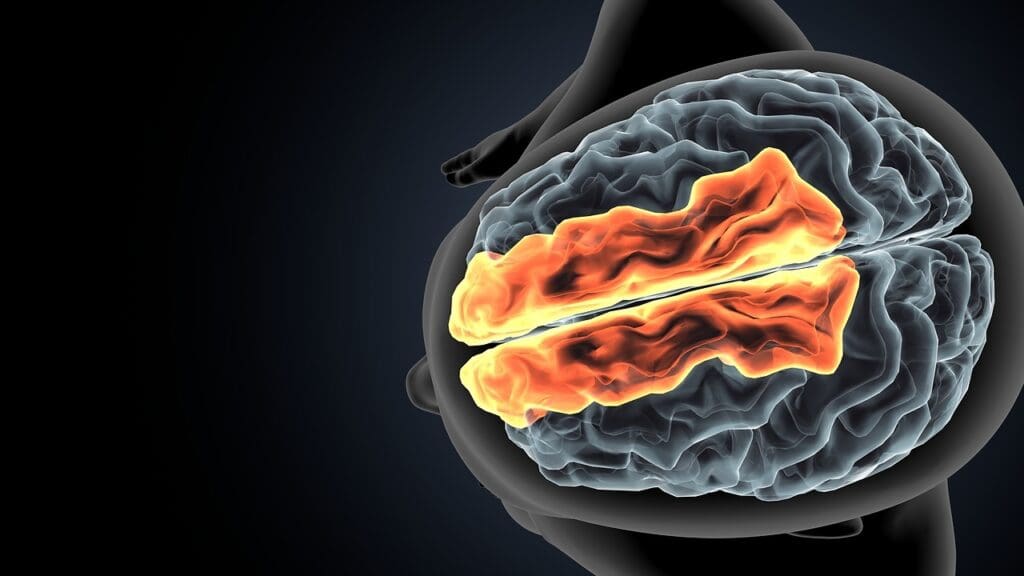 Understanding Brain Tumors Understanding Brain Tumors