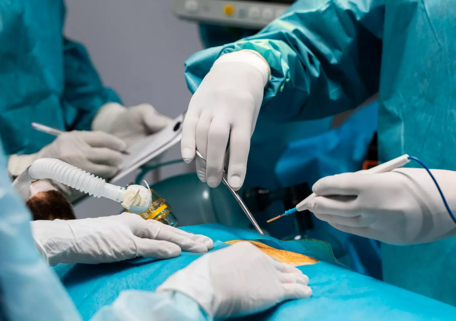 Laparoscopic Hysterectomy: 10 Key Facts on Procedure, Recovery, and Risks
