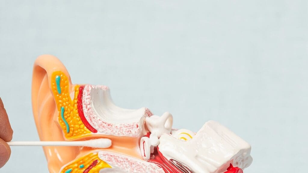 Vestibular Schwannoma Anatomy Vestibular Schwannoma Anatomy