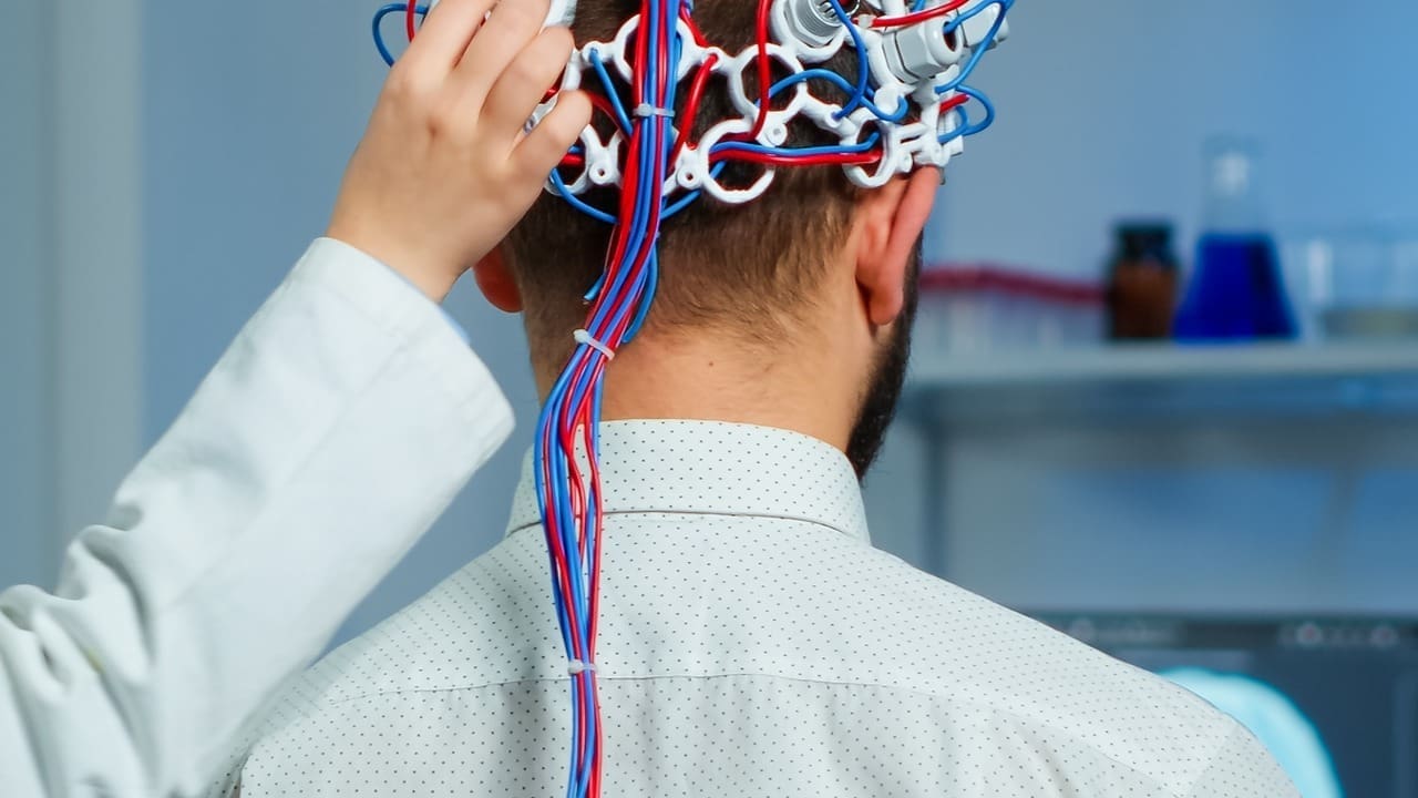 Tumor Causing Vertigo: 7 Key Facts About Vestibular Schwannoma and Acoustic Neuroma