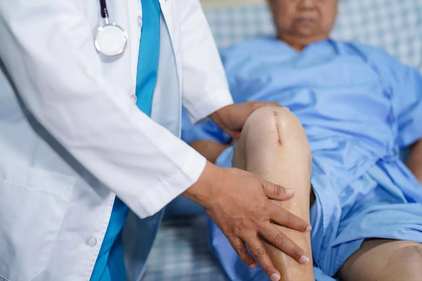 ACL Meniscus Surgery Recovery: 10 Key Milestones and What to Expect