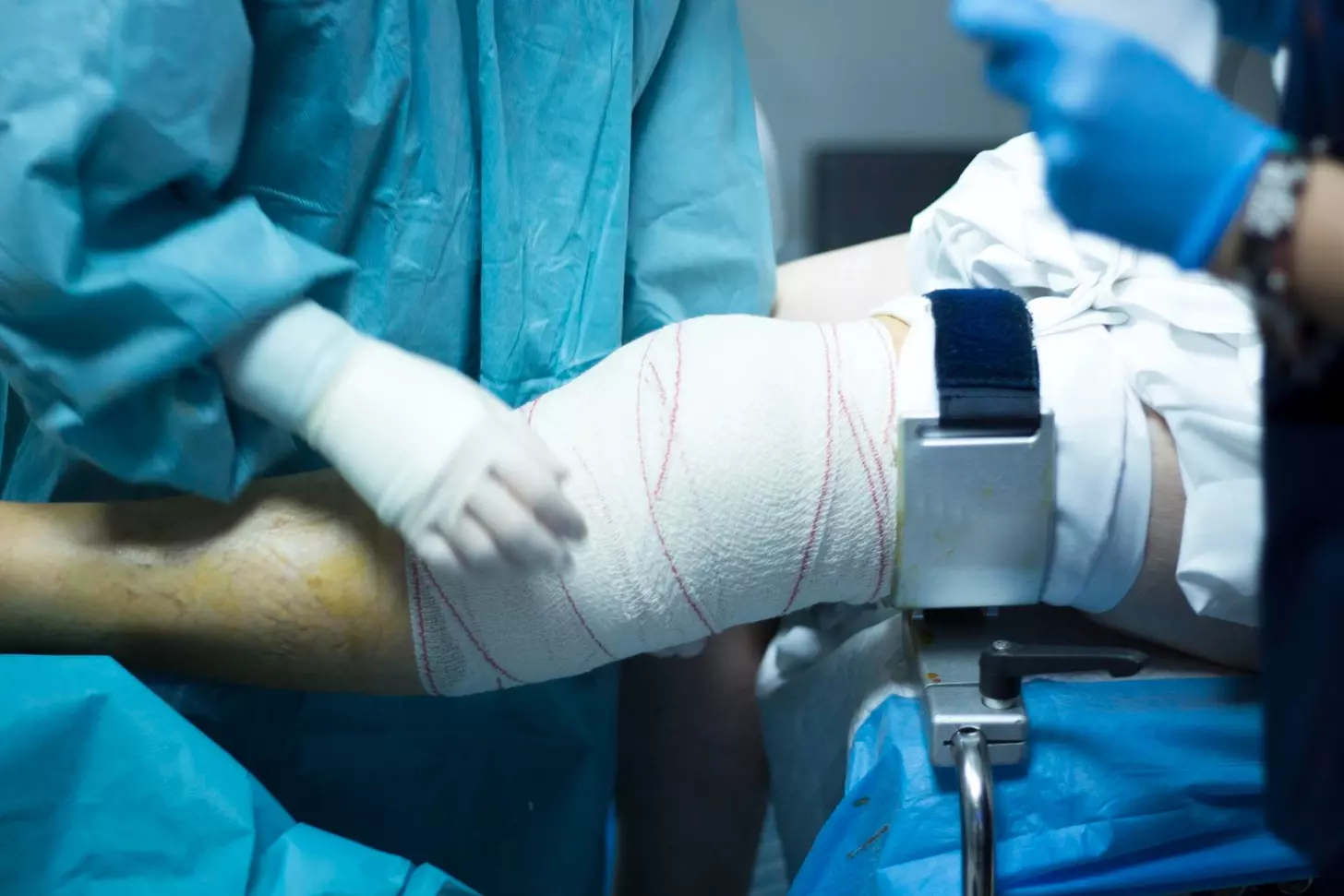 ACL Surgery: 10 Key Facts on Grafting, Repair, and Reconstruction
