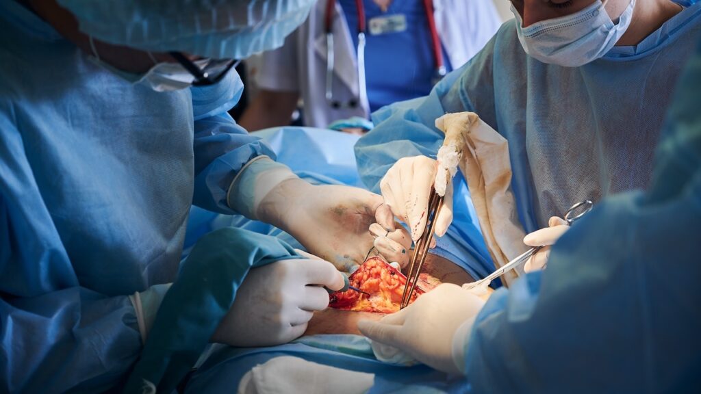 allograft bone graft processing allograft bone graft processing