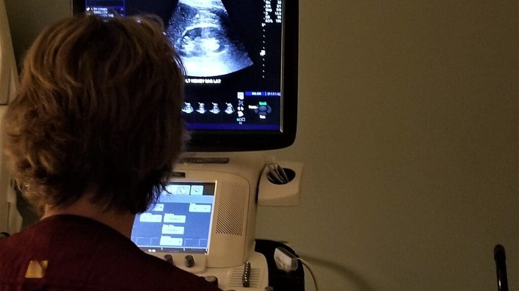 aortic aneurysm screening aortic aneurysm screening