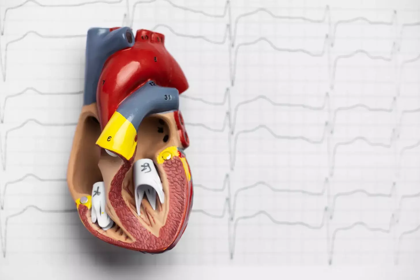 What Are the Atrioventricular Valves and What Is Their Function in the Heart?