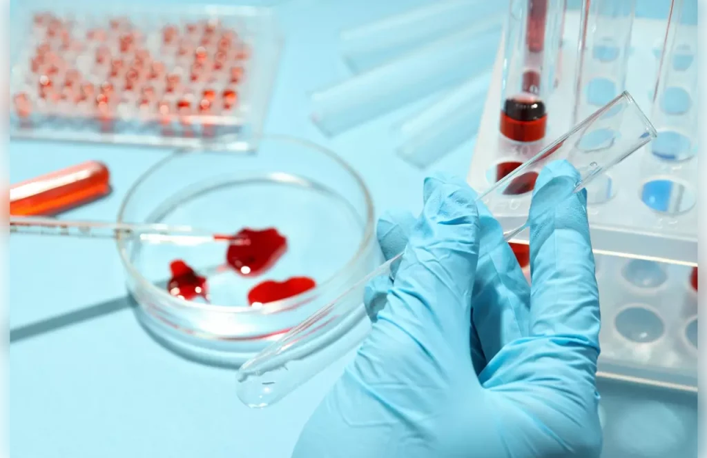 auto stem cell transplant meaning auto stem cell transplant meaning