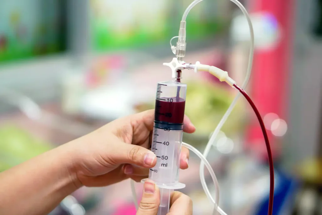 autologous blood donations autologous blood donations