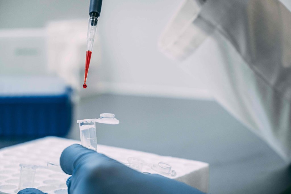 autologous stem cell transplant procedure