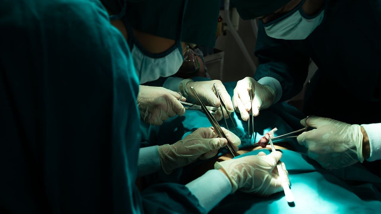 Back Fusion Surgery: 7 Key Facts About Minimally Invasive Lumbar Fusion