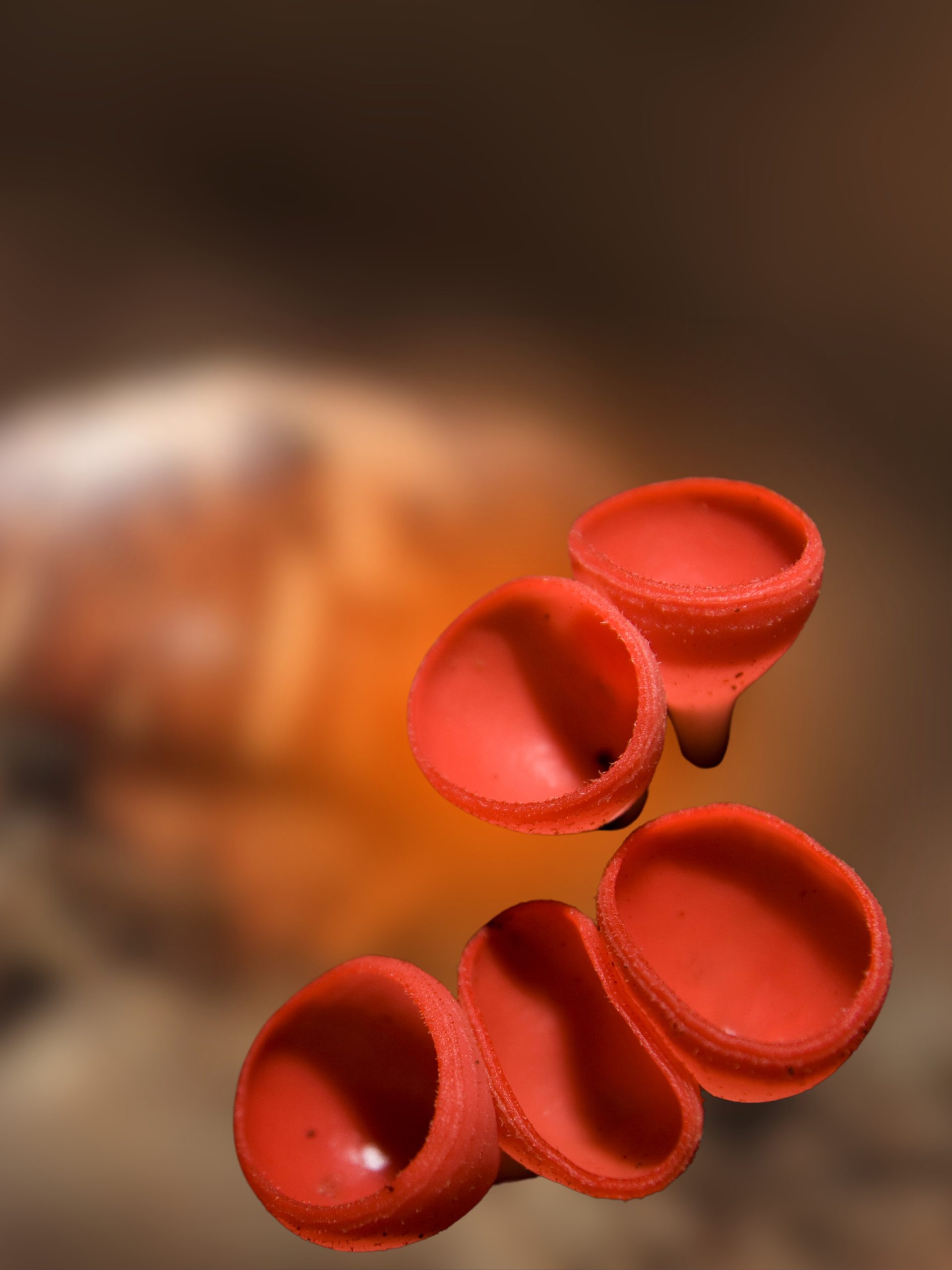 Can Hemophilia Be Cured