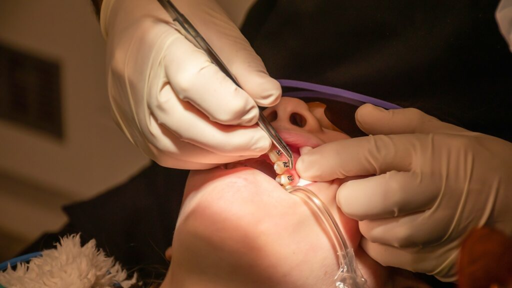 bone grafting bone grafting