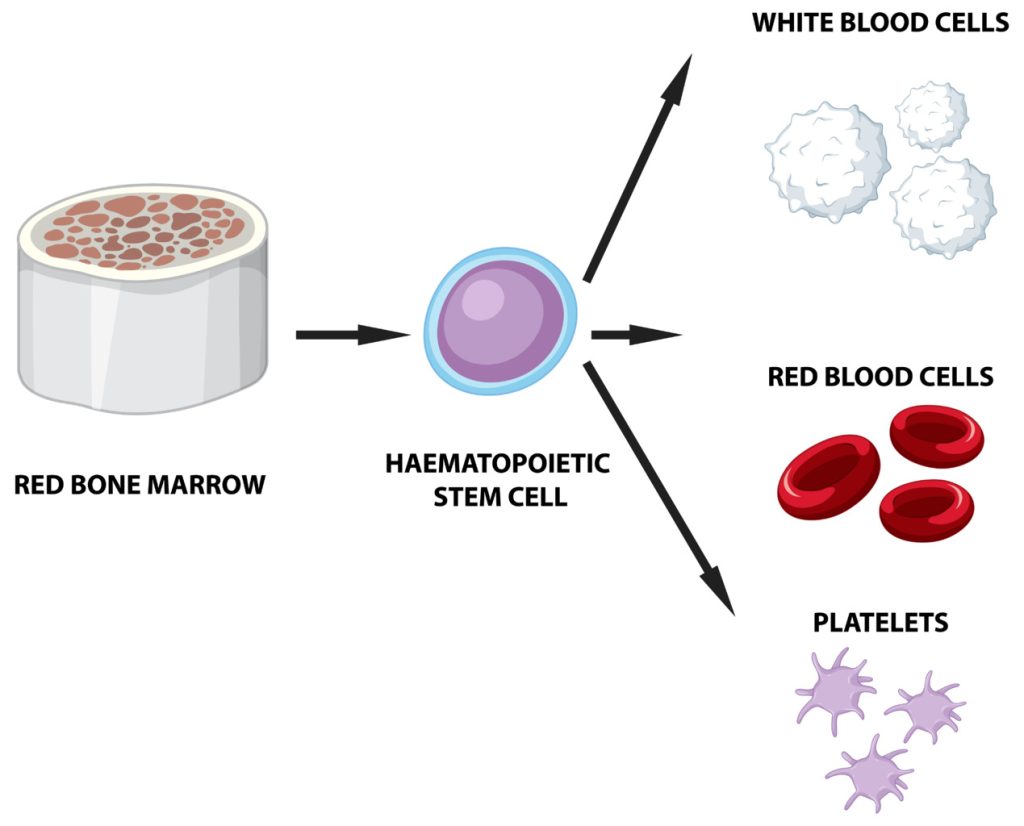 bone marrow with disrupted red blood cell production bone marrow with disrupted red blood cell production